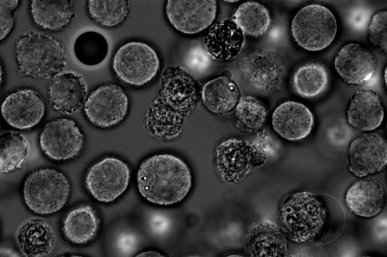 CHO cells and one microbead